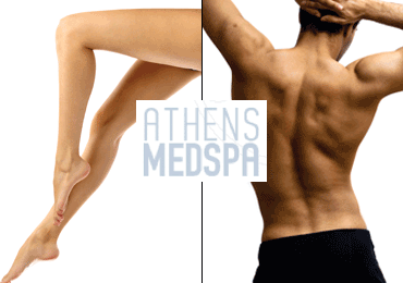 Οριστική αποτρίχωση Laser