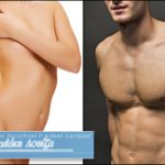 Μόνιμη αποτρίχωση με ιατρικό Laser