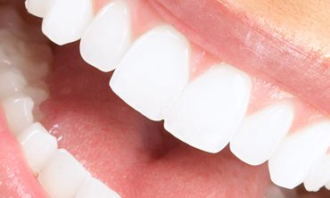 Ολοκληρωμένη περιποίηση δοντιών