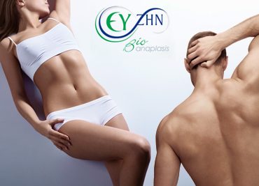 Αποτρίχηση laser Soprano XL στο Ευ ζην