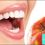 Λεύκανση δοντιών Argident Χαλάνδρι