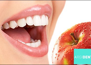 Λεύκανση δοντιών Argident Χαλάνδρι
