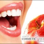 Καθαρισμός δοντιών στο Athens Cosmetic Medicine με μόλις 33€