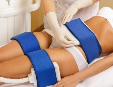 Cryolipolysis