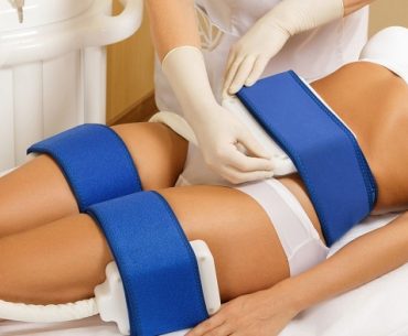 Cryolipolysis